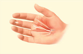 Treating Hand Trauma Treating Hand Trauma