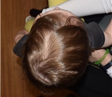 Craniosynostosis After Photo by Rachel Ruotolo, MD; Garden City, NY - Case 38029