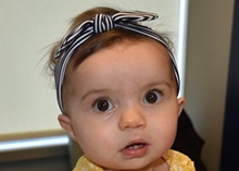Cleft Lip and Palate Repair After Photo by Rachel Ruotolo, MD; Garden City, NY - Case 41348